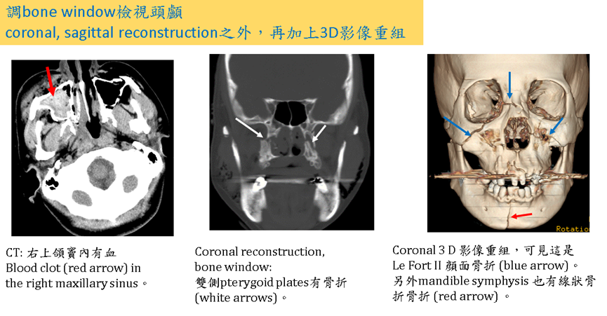 bb2b9cdf91a0c119593facab8cfb2559.png