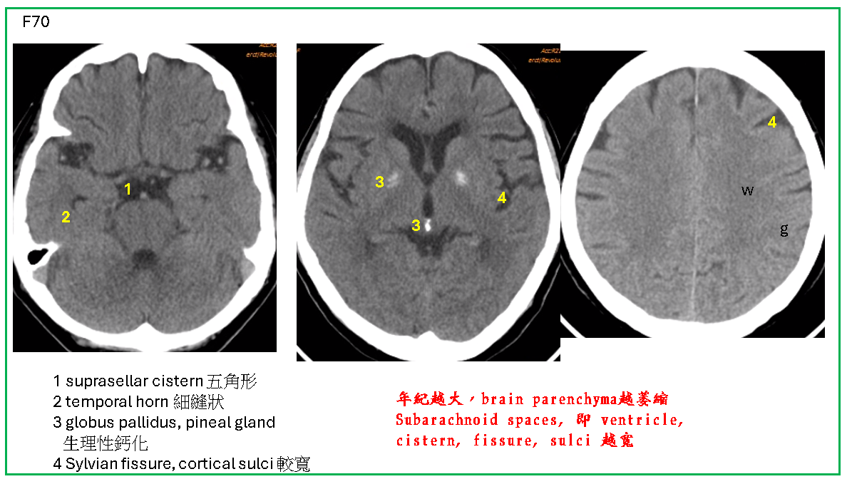 87cf0b8b6b57fca4e838272e3c02e4ed.png