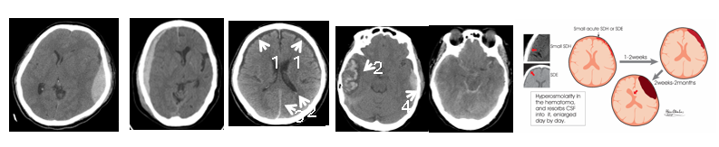 6364e0981ab20885c669d255e0c463d0.png